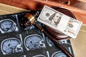 Traumatic brain injury caused by a rideshare accident lawyer